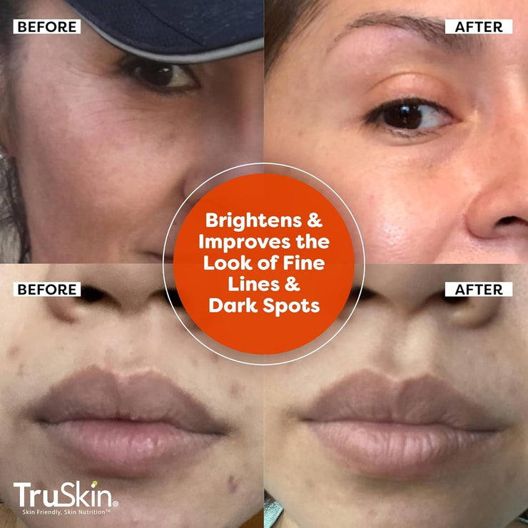 Vitamin C Serum for Face