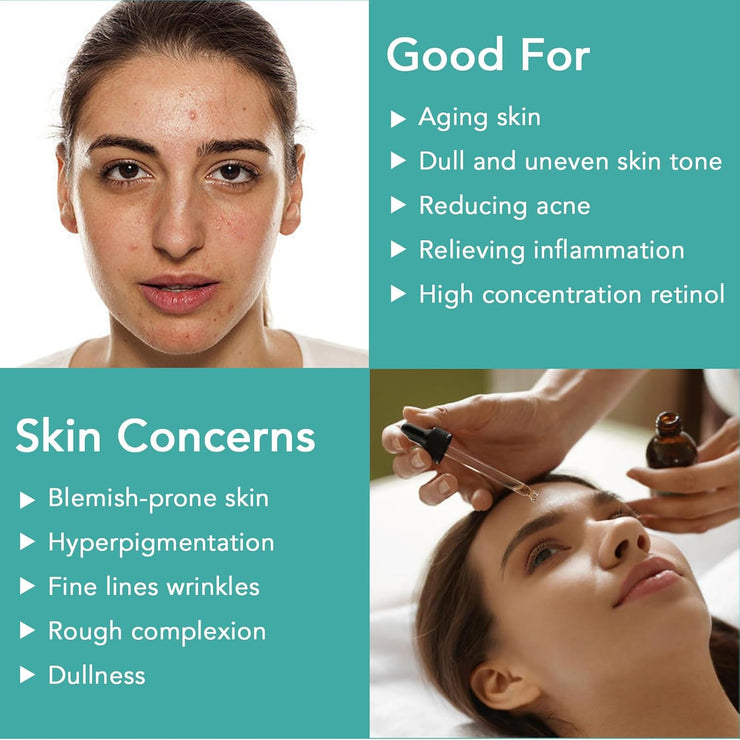 Retinol Anti Aging Serum